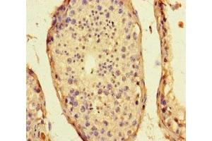Immunohistochemistry of paraffin-embedded human testis tissue using ABIN7169848 at dilution of 1:100 (SMIM1 anticorps  (AA 1-46))