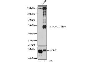 Western blot analysis of extracts of Jurkat cells, using Phospho-NDRG1-S330 pAb (ABIN7268784) at 1:2000 dilution or NDRG1 antibody (ABIN3023025, ABIN3023026, ABIN3023027 and ABIN6219353).