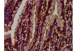 IHC image of ABIN7148294 diluted at 1:500 and staining in paraffin-embedded human small intestine tissue performed on a Leica BondTM system.