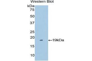 Western blot analysis of the recombinant protein. (Periostin anticorps  (AA 500-630))