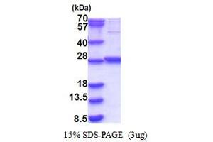 Glycolipid Transfer Protein Domain Containing 1 (GLTPD1) (AA 1-214) protein (His tag)