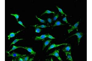 Immunofluorescent analysis of Hela cells using ABIN7156561 at dilution of 1:100