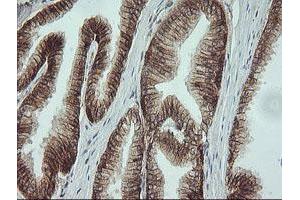 Image no. 7 for anti-Catenin (Cadherin-Associated Protein), beta 1, 88kDa (CTNNB1) antibody (ABIN1496898)