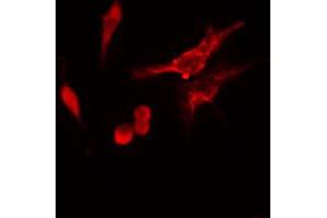 ABIN6274747 staining HeLa cells by IF/ICC. (RPS11 anticorps  (C-Term))