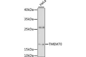 Western blot analysis of extracts of HeLa cells, using TMEM70 antibody (ABIN6133460, ABIN6149268, ABIN6149269 and ABIN6217808) at 1:3000 dilution. (Transmembrane Protein 70 (TMM70) (AA 161-260) anticorps)