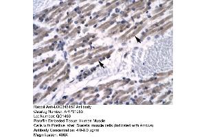 Human Muscle (ZNF391 anticorps  (N-Term))