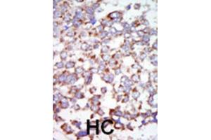 Immunohistochemistry (IHC) image for anti-Nuclear Receptor Subfamily 2, Group C, Member 2 (NR2C2) antibody (ABIN3003597) (TR4 anticorps)