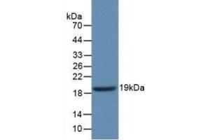 Detection of Recombinant GbA, Human using Polyclonal Antibody to Glucocerebrosidase (GBA) (GBA anticorps  (AA 334-498))