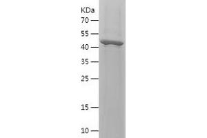 Fibroblast Growth Factor 13 (FGF13) (AA 10-245) protein (His-IF2DI Tag)