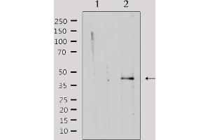 Western blot analysis of extracts from rat muscle, using KAPCG Antibody. (PRKACG anticorps)