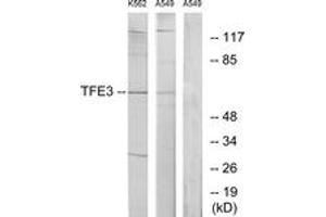Western blot analysis of extracts from K562/A549 cells, using TFE3 Antibody. (TFE3 anticorps  (AA 101-150))