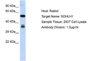 Host: Rabbit Target Name: SOHLH1 Sample Type: 293T Whole Cell lysates Antibody Dilution: 1.