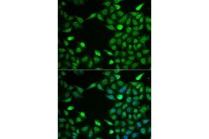 Immunofluorescence analysis of A549 cells using INTS6 antibody. (INTS6 anticorps  (AA 1-280))