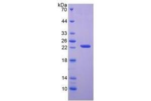 Image no. 1 for Adenine Phosphoribosyltransferase (APRT) (AA 1-180) (Active) protein (His tag) (ABIN6239884)