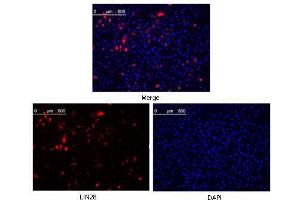 Confocal immunofluorescence analysis of methanol fixed Hela cells were transfected with pMX construct of human LIN28, cells were analyzed ~62 hours after transfection.