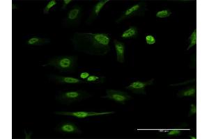 Immunofluorescence of monoclonal antibody to ITGB1BP1 on HeLa cell. (ITGB1BP1 anticorps  (AA 1-200))