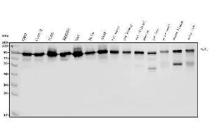 Western blot analysis of DDX1 using anti-DDX1 antibody (ABIN7602050).