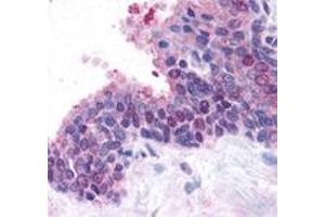 Staining of human prostate, glandular epithelium using FANCD2 polyclonal antibody . (FANCD2 anticorps  (N-Term))