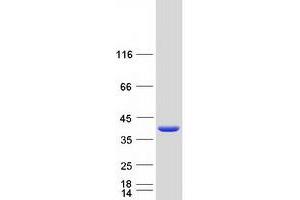 Validation with Western Blot