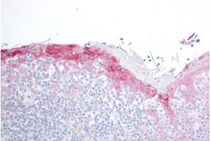 ABIN184852 (10µg/ml) staining of paraffin embedded Human Tonsil. (HSPB8 anticorps  (C-Term))