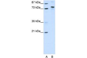 WB Suggested Anti-KIAA0737 Antibody Titration:  1. (TOX4 anticorps  (N-Term))