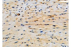 ABIN6261572 and ABIN6272293 at 1/100 staining Mouse heart tissue by IHC-P.