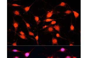 Immunofluorescence analysis of C6 cells using METTL3 Polyclonal Antibody at dilution of 1:100 (40x lens).