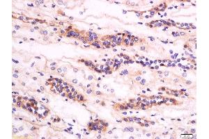 Formalin-fixed and paraffin embedded human kidney labeled with Anti-GM2A Polyclonal Antibody, Unconjugated  at 1:200 followed by conjugation to the secondary antibody and DAB staining (GM2A anticorps  (AA 131-193))