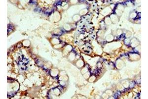 Immunohistochemistry of paraffin-embedded human small intestine tissue using ABIN7152503 at dilution of 1:100 (FBXW4 anticorps  (AA 143-412))