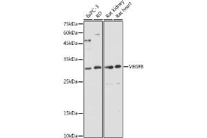 Western blot analysis of extracts of various cell lines, using VEGFB antibody (ABIN6128909, ABIN6150090, ABIN6150092 and ABIN6216417) at 1:1000 dilution.