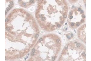 Detection of Nesp2 in Human Kidney Tissue using Polyclonal Antibody to Nesprin 2 (Nesp2)