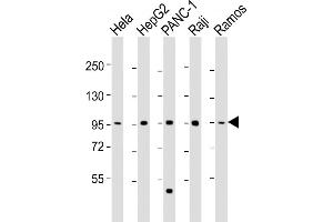 All lanes : Anti-NUGGC Antibody (Center) at 1:2000 dilution Lane 1: Hela whole cell lysate Lane 2: HepG2 whole cell lysate Lane 3: NC-1 whole cell lysate Lane 4: Raji whole cell lysate Lane 5: Ramos whole cell lysate Lysates/proteins at 20 μg per lane.