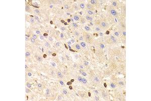 Immunohistochemistry of paraffin-embedded Human liver using LSP1 antibody at dilution of 1:100 (x400 lens). (LSP1 anticorps)