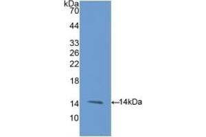 Detection of Recombinant ENG, Rat using Polyclonal Antibody to Endoglin (ENG) (Endoglin anticorps  (AA 26-136))