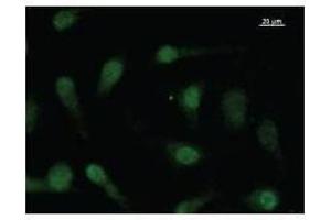 Immunostaining analysis in HeLa cells. (FBXO18 anticorps)