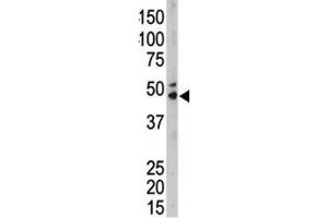 The SPHK1 antibody used in western blot to detect SPHK1 in mouse kidney tissue lysate (SPHK1 anticorps  (AA 286-315))