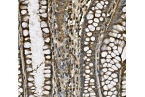 IHC analysis of CD239/BCAM using anti-CD239/BCAM antibody (ABIN7602976). (BCAM anticorps  (Middle Region))