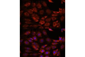 Immunofluorescence analysis of C6 cells using [KO] GIT1 antibody (ABIN7267383) at dilution of 1:100.