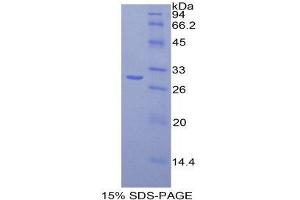 SDS-PAGE (SDS) image for Fatty Acid Synthase (FASN) (AA 2263-2512) protein (His tag) (ABIN2121013)