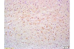 Formalin-fixed and paraffin embedded rat brain tissue labeled with Anti-Thy-1/CD90/ Thy1.