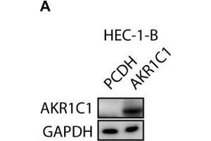 Liquiritin inhibits progesterone metabolism via AKR1C1.