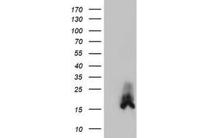 Western Blotting (WB) image for anti-Dual Specificity Phosphatase 23 (DUSP23) antibody (ABIN1497930) (DUSP23 anticorps)