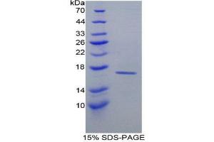SDS-PAGE (SDS) image for Retinol Binding Protein 1, Cellular (RBP1) (AA 2-135) protein (His tag) (ABIN2122007) (RBP1 Protein (AA 2-135) (His tag))