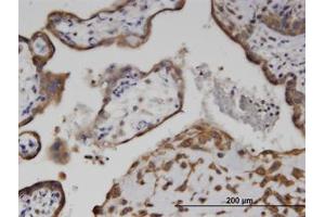 anti-Adenylate Kinase 9 (AK9) (AA 321-422) antibody