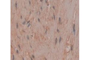 IHC-P analysis of Human Tissue, with DAB staining. (CA3 anticorps  (AA 2-260))