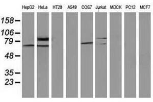Image no. 2 for anti-SAM Domain and HD Domain 1 (SAMHD1) antibody (ABIN1500801) (SAMHD1 anticorps)