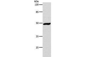 Western Blot analysis of Hela cell using DRD1 Polyclonal Antibody at dilution of 1:1000 (Dopamine Receptor d1 anticorps)