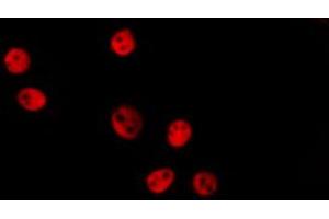 ABIN6274149 staining Hela by IF/ICC. (HMGN2 anticorps  (Internal Region))