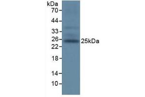 Figure. (TIGIT anticorps  (AA 28-246))