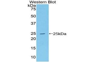 Detection of Recombinant LMP7, Human using Polyclonal Antibody to Large Multifunctional Peptidase 7 (LMP7) (PSMB8 anticorps  (AA 75-261))